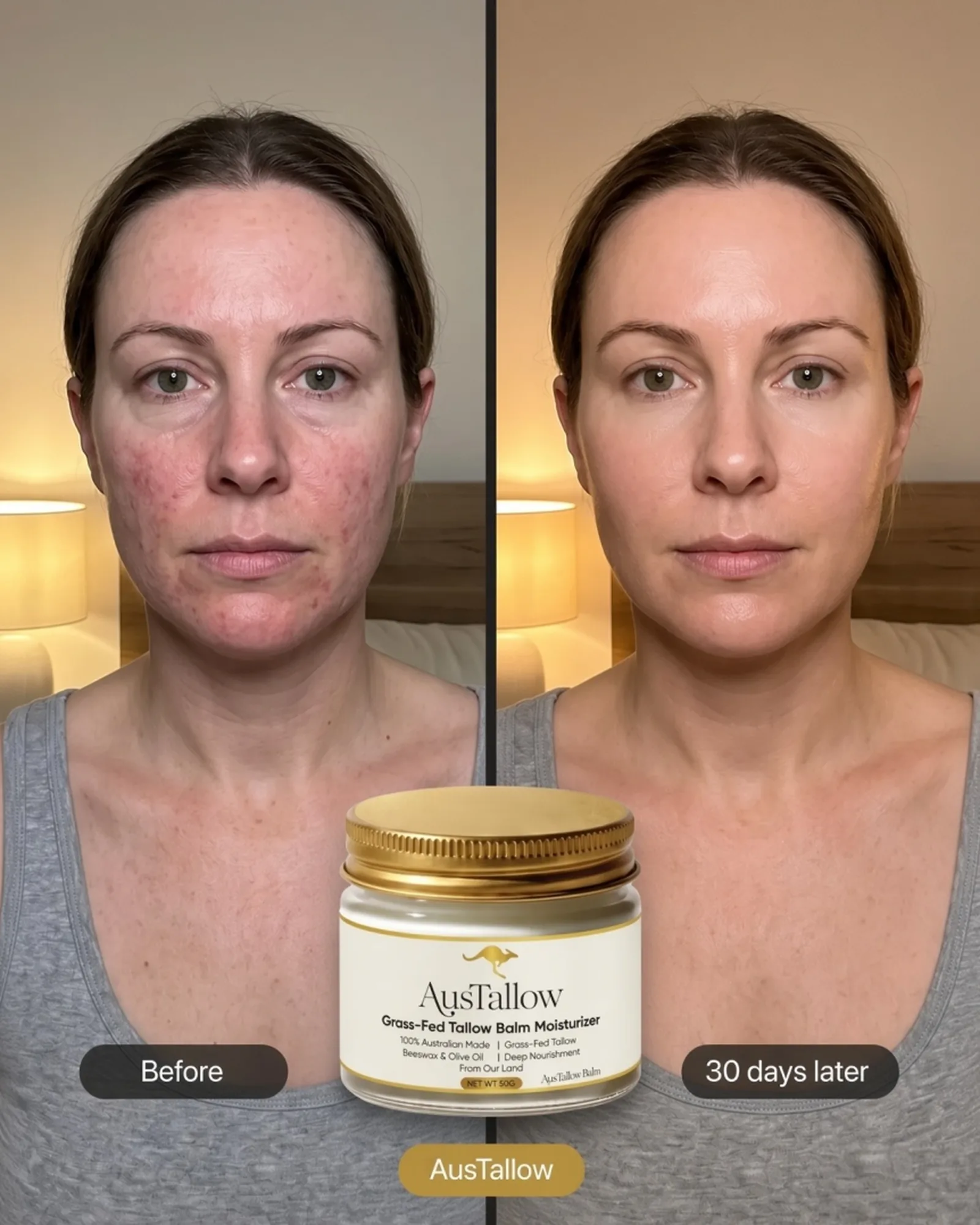 A customer's facial redness at the start and after 30 days of daily use. Individual results vary